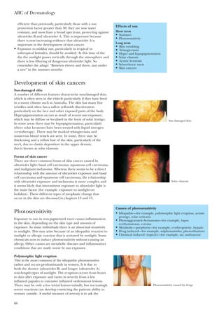 efficient than previously, particularly those with a sun
protection factor greater than 30; they are now water
resistant, and most have a broad spectrum, protecting against
ultraviolet B and ultraviolet A. This is important because
there is now increasing evidence that ultraviolet A is
important in the development of skin cancer.
• Exposure to midday sun, particularly in tropical or
subtropical latitudes, should be avoided. At this time of the
day the sunlight passes vertically through the atmosphere and
there is less filtering of dangerous ultraviolet light. So
remember the adage: “Between eleven and three, stay under
a tree” in the summer months.
Development of skin cancers
Sun-damaged skin
A number of different features characterise sun-damaged skin,
which is often seen in the elderly particularly if they have lived
in a sunny climate such as Australia. The skin has many fine
wrinkles and often has a sallow yellowish discoloration
particularly on the face and other exposed parts of the body.
Hyperpigmentation occurs as result of recent sun exposure,
which may be diffuse or localised in the form of solar lentigo.
In some areas there may be hypopigmentation, particularly
where solar keratoses have been treated with liquid nitrogen
(cryotherapy). There may be marked telangiectasia and
numerous blood vessels are seen. In some, there may be
thickening and a yellow hue of the skin, particularly of the
neck, due to elastin deposition in the upper dermis;
this is known as solar elastosis.
Forms of skin cancer
There are three common forms of skin cancer caused by
ultraviolet light: basal cell carcinoma, squamous cell carcinoma,
and malignant melanoma. Whereas there seems to be a direct
relationship with the amount of ultraviolet exposure and basal
cell carcinoma and squamous cell carcinoma, the relationship
with ultraviolet exposure and melanoma is more complex and
it seems likely that intermittent exposure to ultraviolet light is
the main factor (for example, exposure to sunlight on
holidays). These different types of neoplastic change that
occur in the skin are discussed in chapters 13 and 15.
Photosensitivity
Exposure to sun in non-pigmented races causes inflammation
in the skin, depending on the skin type and amount of
exposure. In some individuals there is an abnormal sensitivity
to sunlight. This may arise because of an idiopathic reaction to
sunlight or allergic reaction that is activated by sunlight. Some
chemicals seen to induce photosensitivity without causing an
allergy. Other causes are metabolic diseases and inflammatory
conditions that are made worse by sun exposure.
Polymorphic light eruption
This is the most common of the idiopathic photosensitive
rashes and occurs predominantly in women. It is due to
both the shorter (ultraviolet B) and longer (ultraviolet A)
wavelength types of sunlight. The eruption occurs from hours
to days after exposure and varies in severity from a few
inflamed papules to extensive inflamed oedematous lesions.
There may be only a few trivial lesions initially, but increasingly
severe reactions can develop restricting the patients ability to
venture outside. A useful measure of seventy is to ask the
ABC of Dermatology
66
Effects of sun
Short term
• Sunburn
• Photosensitivity
Long term
• Skin wrinkling
• Telangiectasia
• Hyper and hypopigmentation
• Solar elastosis
• Actinic keratosis
• Seborrhoeic warts
• Skin cancers
Causes of photosensitivity
• Idiopathic—for example, polymorphic light eruption, actinic
prurigo, solar urticaria
• Photoaggravated dermatoses—for example, lupus
erythematosus, eczema
• Metabolic—porphyria—for example, erythropoietic, hepatic
• Drug induced—for example, sulphonamides, phenothiazines
• Chemical induced (topical)—for example, tar, anthracene
Sun damaged skin
Solar elastosis
Photosensitivity caused by drugs
 