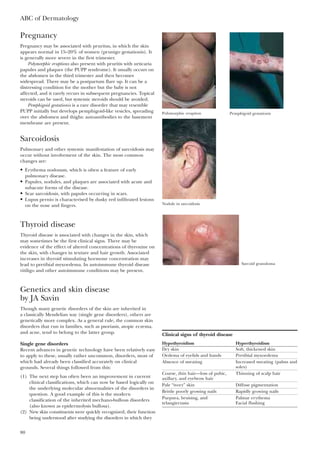 ABC of Dermatology
80
Pregnancy
Pregnancy may be associated with pruritus, in which the skin
appears normal in 15–20% of women (prunigo gestationis). It
is generally more severe in the first trimester.
Polymorphic eruptions also present with pruritis with urticaria
papules and plaques (the PUPP syndrome). It usually occurs on
the abdomen in the third trimester and then becomes
widespread. There may be a postpartum flare up. It can be a
distressing condition for the mother but the baby is not
affected, and it rarely recurs in subsequent pregnancies. Topical
steroids can be used, but systemic steroids should be avoided.
Pemphigoid gestationis is a rare disorder that may resemble
PUPP initially but develops pemphigoid-like vesicles, spreading
over the abdomen and thighs: autoantibodies to the basement
membrane are present.
Sarcoidosis
Pulmonary and other systemic manifestation of sarcoidosis may
occur without involvement of the skin. The most common
changes are:
• Erythema nodosum, which is often a feature of early
pulmonary disease.
• Papules, nodules, and plaques are associated with acute and
subacute forms of the disease.
• Scar sarcoidosis, with papules occurring in scars.
• Lupus pernio is characterised by dusky red infiltrated lesions
on the nose and fingers.
Thyroid disease
Thyroid disease is associated with changes in the skin, which
may sometimes be the first clinical signs. There may be
evidence of the effect of altered concentrations of thyroxine on
the skin, with changes in texture and hair growth. Associated
increases in thyroid stimulating hormone concentration may
lead to pretibial myxoedema. In autoimmune thyroid disease
vitiligo and other autoimmune conditions may be present.
Genetics and skin disease
by JA Savin
Though many genetic disorders of the skin are inherited in
a classically Mendelian way (single gene disorders), others are
genetically more complex. As a general rule, the common skin
disorders that run in families, such as psoriasis, atopic eczema,
and acne, tend to belong to the latter group.
Single gene disorders
Recent advances in genetic technology have been relatively easy
to apply to these, usually rather uncommon, disorders, most of
which had already been classified accurately on clinical
grounds. Several things followed from this:
(1) The next step has often been an improvement in current
clinical classifications, which can now be based logically on
the underlying molecular abnormalities of the disorders in
question. A good example of this is the modern
classification of the inherited mechano-bullous disorders
(also known as epidermolysis bullosa).
(2) New skin constituents were quickly recognized, their function
being understood after studying the disorders in which they
Clinical signs of thyroid disease
Hypothyroidism Hyperthyroidism
Dry skin Soft, thickened skin
Oedema of eyelids and hands Pretibial myxoedema
Absence of sweating Increased sweating (palms and
soles)
Coarse, thin hair—loss of pubic, Thinning of scalp hair
axillary, and eyebrow hair
Pale “ivory” skin Diffuse pigmentation
Brittle poorly growing nails Rapidly growing nails
Purpura, bruising, and Palmar erythema
telangiectasia Facial flushing
Polymorphic eruption Pemphigoid gestationis
Nodule in sarcoidosis
Sarcoid granuloma
 