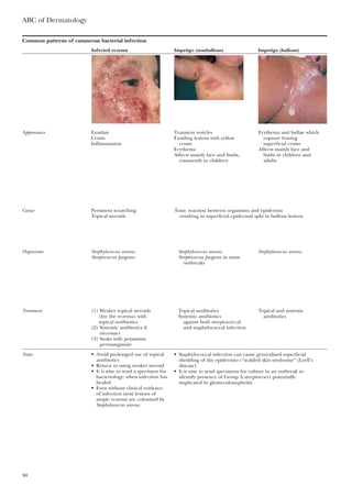 ABC of Dermatology
90
Common patterns of cutaneous bacterial infection
Infected eczema Impetigo (nonbullous) Impetigo (bullous)
Appearance Exudate Transient vesicles Erythema and bullae which
Crusts Exuding lesions with yellow rupture leaving
Inflammation crusts superficial crusts
Erythema Affects mainly face and
Affects mainly face and limbs, limbs in children and
commonly in children adults
Cause Persistent scratching Toxic reaction between organisms and epidermis
Topical steroids resulting in superficial epidermal split in bullous lesions
Organisms Staphylococcus aureus Staphylococcus aureus Staphylococcus aureus
Streptococcus pyogenes Streptococcus pyogenes in some
outbreaks
Treatment (1) Weaker topical steroids Topical antibiotics Topical and systemic
(for the eczema) with Systemic antibiotics antibiotics
topical antibiotics against both streptococcal
(2) Systemic antibiotics if and staphylococcal infection
necessary
(3) Soaks with potassium
permanganate
Notes • Staphylococcal infection can cause generalised superficial
shedding of the epidermis—“scalded skin syndrome” (Lyell’s
disease)
• It is wise to send specimens for culture in an outbreak to
identify presence of Group A streptococci potentially
implicated in glomerulonephritis
• Avoid prolonged use of topical
antibiotics
• Return to using weaker steroid
• It is wise to send a specimen for
bacteriology: when infection has
healed
• Even without clinical evidence
of infection most lesions of
atopic eczema are colonised by
Staphylococcus aureus
 