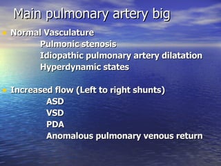 Main pulmonary artery big Normal Vasculature               Pulmonic stenosis                                      Idiopathic pulmonary artery dilatation               Hyperdynamic states  Increased flow (Left to right shunts)  ASD             VSD                                                           PDA                                                          Anomalous pulmonary venous return    
