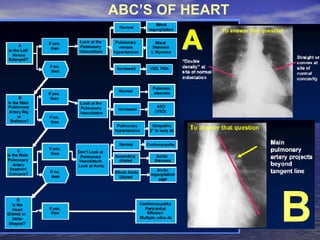 ABC’S OF HEART  B 