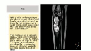 Comprehensive Overview of Aneurysmal Bone Cyst: Diagnosis and Imaging ...