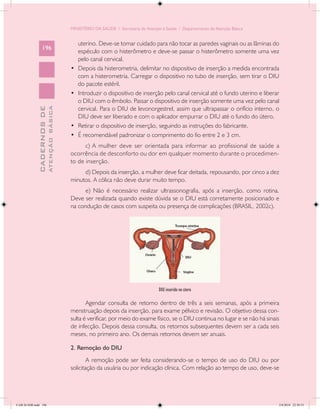 MINISTÉRIO DA SAÚDE / Secretaria de Atenção à Saúde / Departamento de Atenção Básica


                                                 uterino. Deve-se tomar cuidado para não tocar as paredes vaginais ou as lâminas do
                 196
                                                 espéculo com o histerômetro e deve-se passar o histerômetro somente uma vez
                                                 pelo canal cervical.
                                            •	   Depois da histerometria, delimitar no dispositivo de inserção a medida encontrada
                                                 com a histerometria. Carregar o dispositivo no tubo de inserção, sem tirar o DIU
                                                 do pacote estéril.
                                            •	   Introduzir o dispositivo de inserção pelo canal cervical até o fundo uterino e liberar
                                                 o DIU com o êmbolo. Passar o dispositivo de inserção somente uma vez pelo canal
                                                 cervical. Para o DIU de levonorgestrel, assim que ultrapassar o orifício interno, o
                           ATENÇÃO BÁSICA
             CADERNOS DE




                                                 DIU deve ser liberado e com o aplicador empurrar o DIU até o fundo do útero.
                                            •	   Retirar o dispositivo de inserção, seguindo as instruções do fabricante.
                                            •	   É recomendável padronizar o comprimento do fio entre 2 e 3 cm.
                                                  c) A mulher deve ser orientada para informar ao profissional de saúde a
                                            ocorrência de desconforto ou dor em qualquer momento durante o procedimen-
                                            to de inserção.
                                                 d) Depois da inserção, a mulher deve ficar deitada, repousando, por cinco a dez
                                            minutos. A cólica não deve durar muito tempo.
                                                  e) Não é necessário realizar ultrassonografia, após a inserção, como rotina.
                                            Deve ser realizada quando existe dúvida se o DIU está corretamente posicionado e
                                            na condução de casos com suspeita ou presença de complicações (BRASIL, 2002c).




                                                                                       DIU inserido no útero

                                                   Agendar consulta de retorno dentro de três a seis semanas, após a primeira
                                            menstruação depois da inserção, para exame pélvico e revisão. O objetivo dessa con-
                                            sulta é verificar, por meio do exame físico, se o DIU continua no lugar e se não há sinais
                                            de infecção. Depois dessa consulta, os retornos subsequentes devem ser a cada seis
                                            meses, no primeiro ano. Os demais retornos devem ser anuais.

                                            2. Remoção do DIU
                                                    A remoção pode ser feita considerando-se o tempo de uso do DIU ou por
                                            solicitação da usuária ou por indicação clínica. Com relação ao tempo de uso, deve-se




CAB 26 SSR.indd 196                                                                                                                   2/8/2010 22:30:53
 