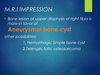 Abc case powerpoint | PPT
