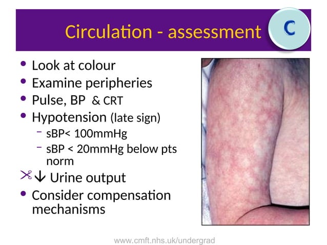 ABCDE ATLS guidelines and management of trauma.ppt | First Aid | Injuries