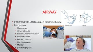 ABCDE assessment for emergency situation | PPTX