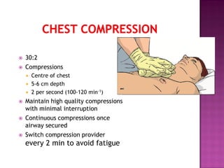 30:2
 Compressions
 Centre of chest
 5-6 cm depth
 2 per second (100-120 min-1)
 Maintain high quality compressions
with minimal interruption
 Continuous compressions once
airway secured
 Switch compression provider
every 2 min to avoid fatigue
 