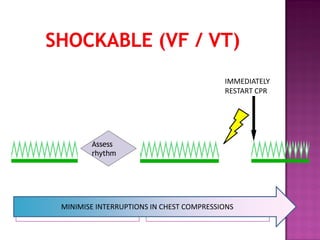 MINIMISE INTERRUPTIONS IN CHEST COMPRESSIONS
Assess
rhythm
IMMEDIATELY
RESTART CPR
MINIMISE INTERRUPTIONS IN CHEST COMPRESSIONS
 