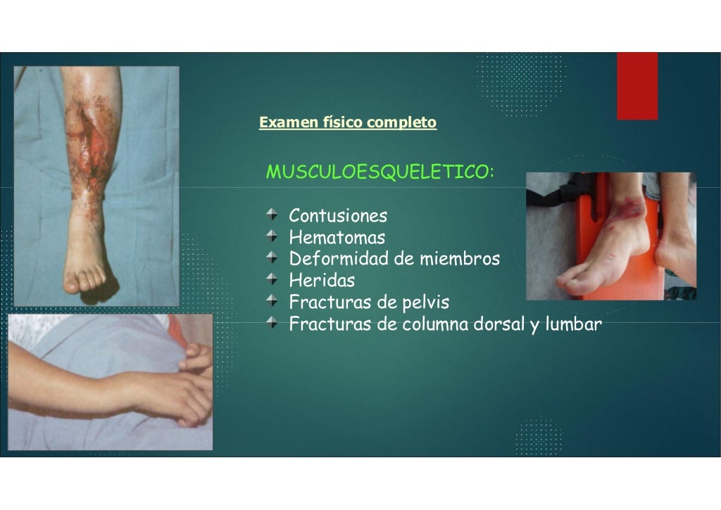 EL A B C DEL MANEJO DEL TRAUMA