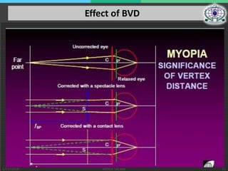 optic of contact lens | PPTX