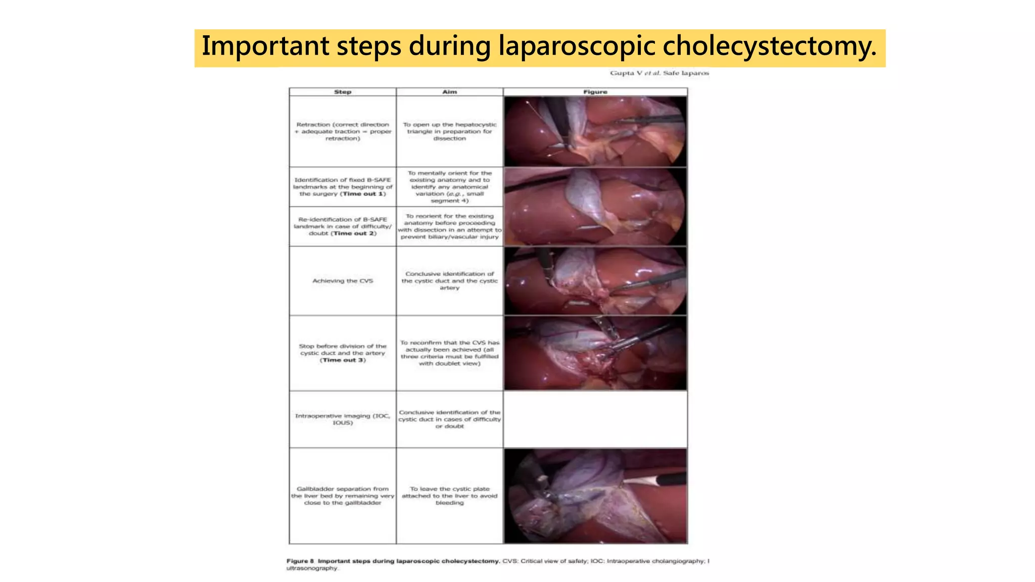 Important steps during laparoscopic cholecystectomy.
 