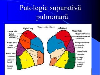 Patologie supurativă
pulmonară
 