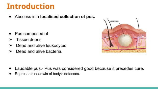 abcess.pptx surgery ppt management causes | PPTX