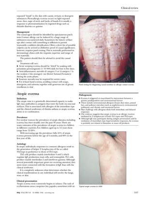 Nape Testing ABC of Allergies PDF .pdf,for medical students and general ...