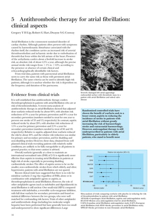 Abc of antithrombotic therapy | PDF