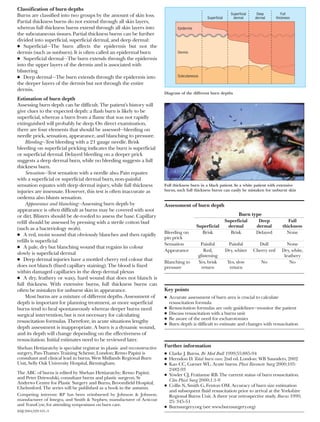 Abc of burns | PDF
