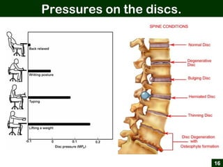 Pressures on the discs.
16
 