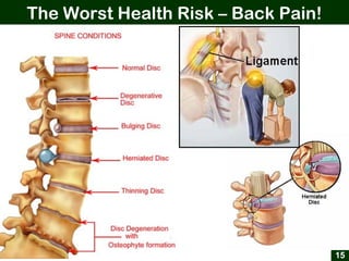The Worst Health Risk – Back Pain!
15
 