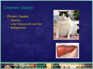 Common Causes
• Chronic Causes
– Obesity
– Liver failure with ascities
– Malignancies
 