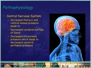 Pathophysiology
• Central Nervous System
– Increased thoracic and
central venous pressure
leads to
– Decreased cerebral outflow
of blood
– Increased intracranial
pressure which leads to
decreased cerebral
perfusion pressure
 