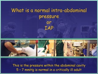 What is a normal intra-abdominal
pressure
or
IAP
This is the pressure within the abdominal cavity
5 – 7 mmHg is normal in a critically ill adult
 