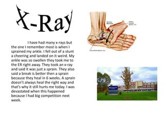 I have had many x-rays but
the one I remember most is when I
sprained my ankle. I fell out of a stunt
a cheering and landed on it weird. My
ankle was so swollen they took me to
the ER right away. They took an x-ray
and said it was just a sprain. They also
said a break is better then a sprain
because they heal in 6 weeks. A sprain
doesn’t always heal the right way and
that’s why it still hurts me today. I was
devastated when this happened
because I had big competition next
week.
 