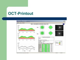 OCT-Printout 