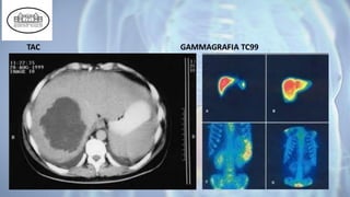 TAC GAMMAGRAFIA TC99
 