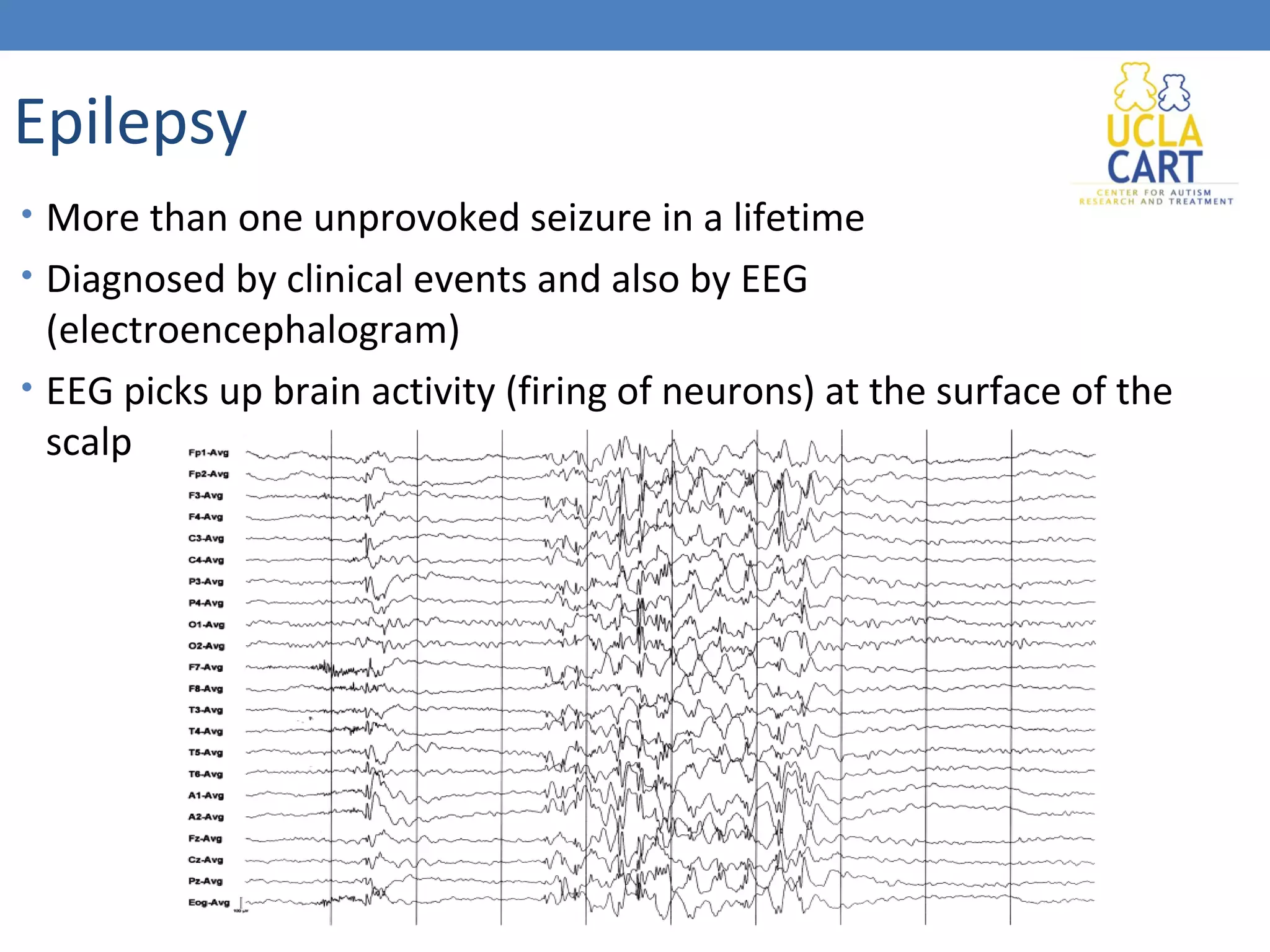 Epilepsy 
• More than one unprovoked seizure in a lifetime 
• Diagnosed by clinical events and also by EEG 
(electroencephalogram) 
• EEG picks up brain activity (firing of neurons) at the surface of the 
scalp 
 