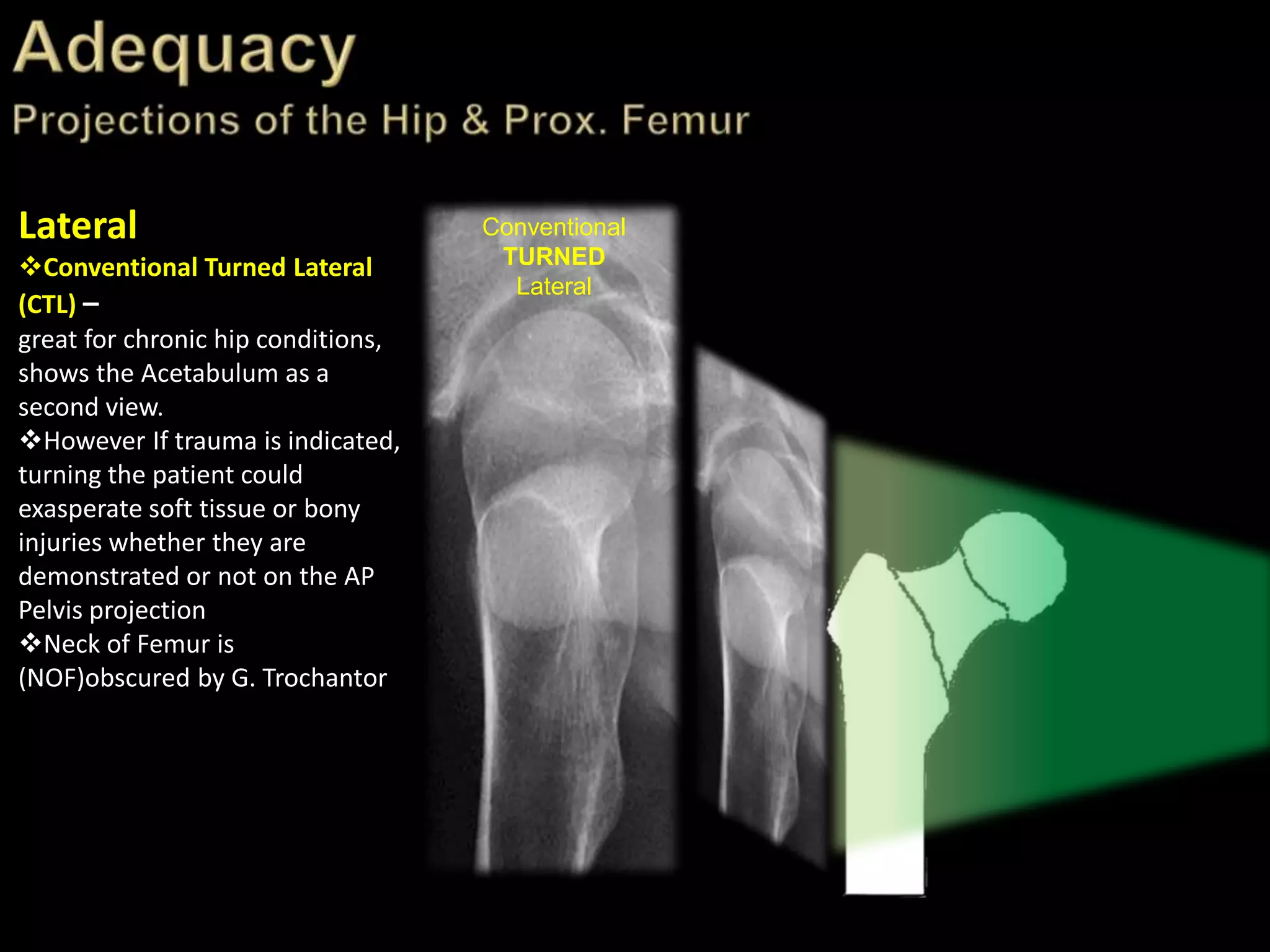 Trauma Image Interpretation of the Pelvis and Hip Radiographs: Using ...