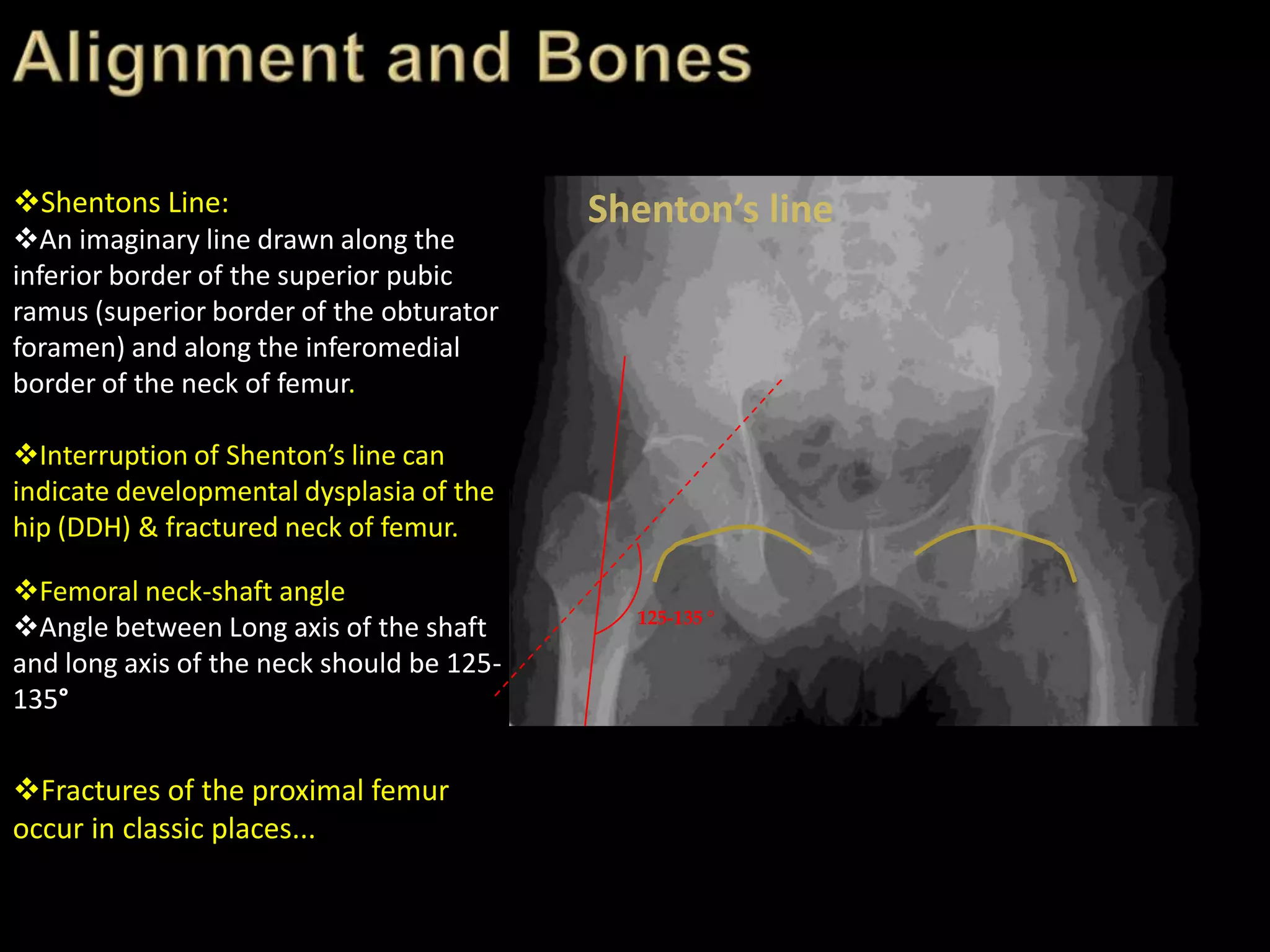 Trauma Image Interpretation of the Pelvis and Hip Radiographs: Using ...