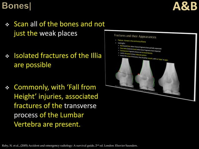 Trauma Image Interpretation of the Pelvis and Hip Radiographs: Using ...
