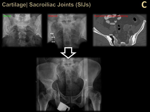 Trauma Image Interpretation of the Pelvis and Hip Radiographs: Using ...
