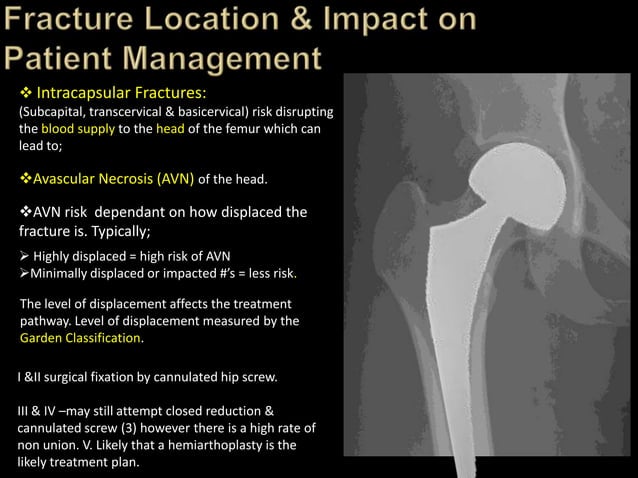 Trauma Image Interpretation of the Pelvis and Hip Radiographs: Using ...