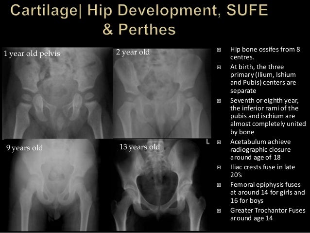 Trauma Image Interpretation of the Pelvis and Hip Radiographs: Using…