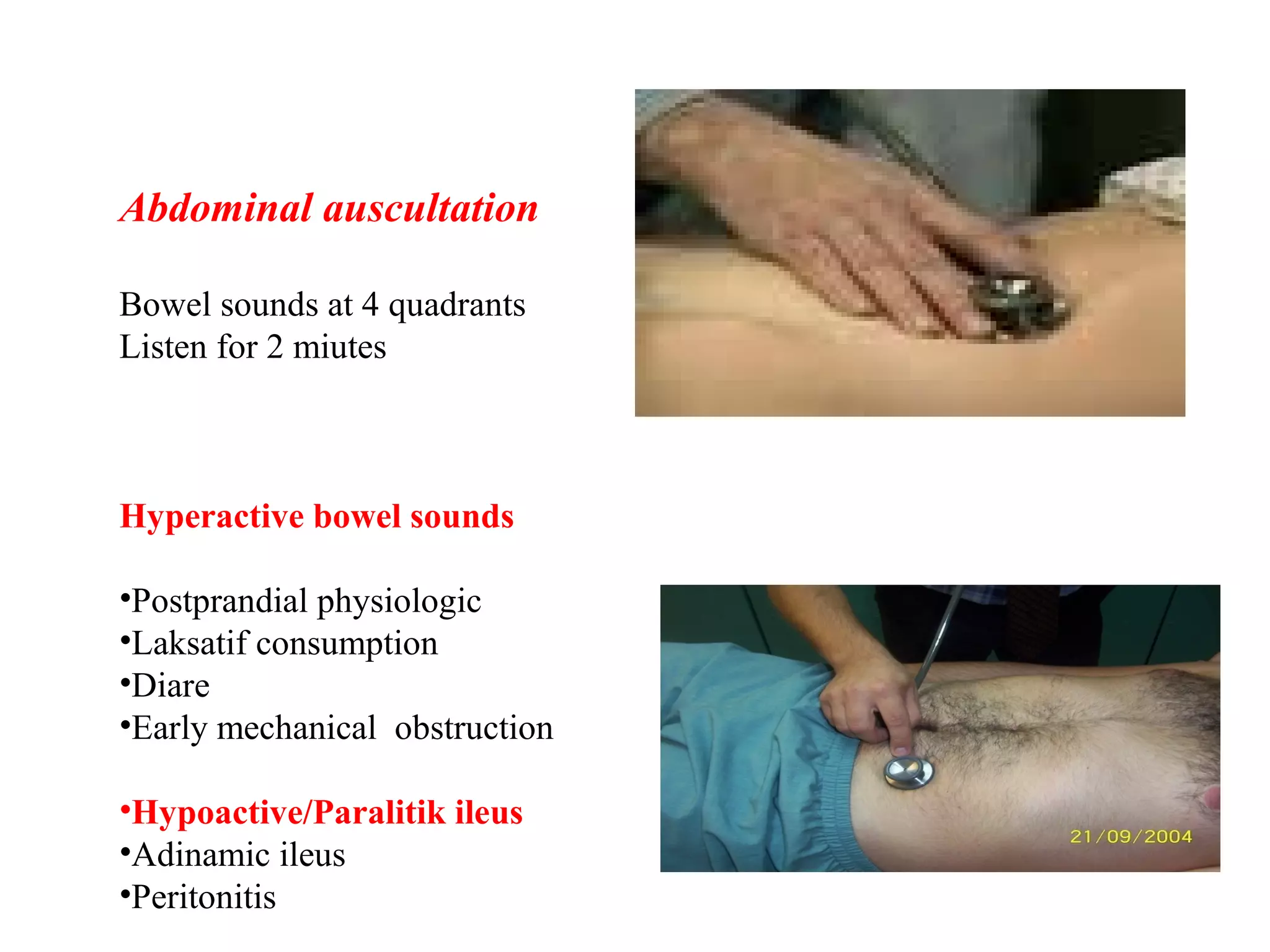 Abdominal Examination | PPT