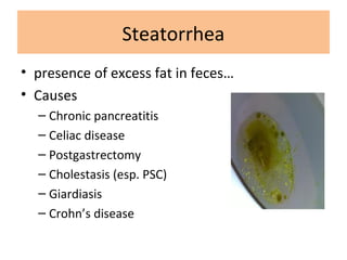 Steatorrhea
• presence of excess fat in feces…
• Causes
– Chronic pancreatitis
– Celiac disease
– Postgastrectomy
– Cholestasis (esp. PSC)
– Giardiasis
– Crohn’s disease
 