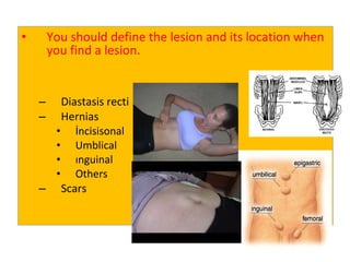 • You should define the lesion and its location when
you find a lesion.
– Diastasis recti
– Hernias
• İncisisonal
• Umblical
• ınguinal
• Others
– Scars
 