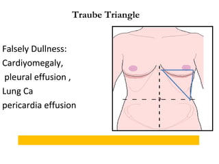 Traube Triangle
Falsely Dullness:
Cardiyomegaly,
pleural effusion ,
Lung Ca
pericardia effusion
 