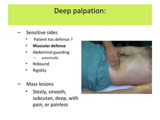 Deep palpation:
– Sensitive sides
• Patient has defence ?
• Muscular defense
• Abdominal guarding
– automically
• Rebound
• Rigidity
– Mass lesions
• Steely, smooth,
subcutan, deep, with
pain, or painless
 