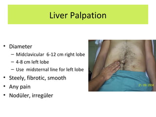 Liver Palpation
• Diameter
– Midclavicular 6-12 cm right lobe
– 4-8 cm left lobe
– Use midsternal line for left lobe
• Steely, fibrotic, smooth
• Any pain
• Nodüler, irregüler
 