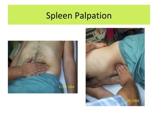 Spleen Palpation
 