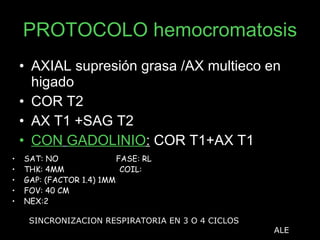 PROTOCOLO hemocromatosis AXIAL supresión grasa /AX multieco en higado COR T2 AX T1 +SAG T2  CON   GADOLINIO :  COR T1+AX T1 SAT: NO  FASE: RL THK: 4MM  COIL:  GAP: (FACTOR 1.4) 1MM FOV: 40 CM NEX:2 SINCRONIZACION RESPIRATORIA EN 3 O 4 CICLOS ALE 