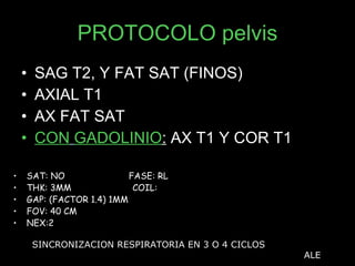 PROTOCOLO pelvis SAG T2, Y FAT SAT (FINOS) AXIAL T1  AX FAT SAT CON   GADOLINIO :  AX T1 Y COR T1 SAT: NO  FASE: RL THK: 3MM  COIL:  GAP: (FACTOR 1.4) 1MM FOV: 40 CM NEX:2 SINCRONIZACION RESPIRATORIA EN 3 O 4 CICLOS ALE 