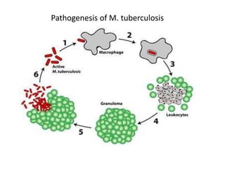 Pathogenesis of M. tuberculosis
 