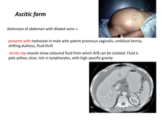 Ascitic form
distension of abdomen with dilated veins +.
presents with hydrocele in male with patent processus vaginalis, umbilical hernia,
shifting dullness, fluid thrill
Ascitic tap reveals straw coloured fluid from which AFB can be isolated. Fluid is
pale yellow, clear, rich in lymphocytes, with high specific gravity.
 