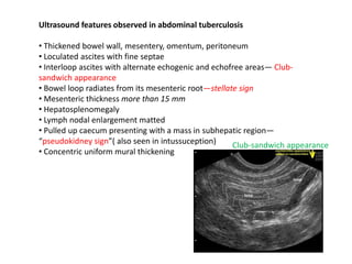 Ultrasound features observed in abdominal tuberculosis
• Thickened bowel wall, mesentery, omentum, peritoneum
• Loculated ascites with fine septae
• Interloop ascites with alternate echogenic and echofree areas— Club-
sandwich appearance
• Bowel loop radiates from its mesenteric root—stellate sign
• Mesenteric thickness more than 15 mm
• Hepatosplenomegaly
• Lymph nodal enlargement matted
• Pulled up caecum presenting with a mass in subhepatic region—
“pseudokidney sign”( also seen in intussuception)
• Concentric uniform mural thickening
Club-sandwich appearance
 