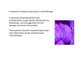• treatment of hepatic tuberculosis is chemotherapy
It should be remembered that most
antituberculous drugs (except ethambutol) are
hepatotoxic, and may aggravate the liver
damage and worsen the jaundice.
These patients therefore should be kept under
close observation during antituberculous
chemotherapy.
 