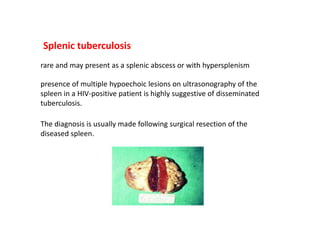 Splenic tuberculosis
rare and may present as a splenic abscess or with hypersplenism
presence of multiple hypoechoic lesions on ultrasonography of the
spleen in a HIV-positive patient is highly suggestive of disseminated
tuberculosis.
The diagnosis is usually made following surgical resection of the
diseased spleen.
 