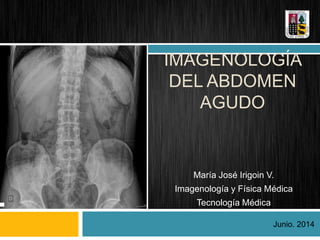 IMAGENOLOGÍA
DEL ABDOMEN
AGUDO
María José Irigoin V.
Imagenología y Física Médica
Tecnología Médica
Junio. 2014
 